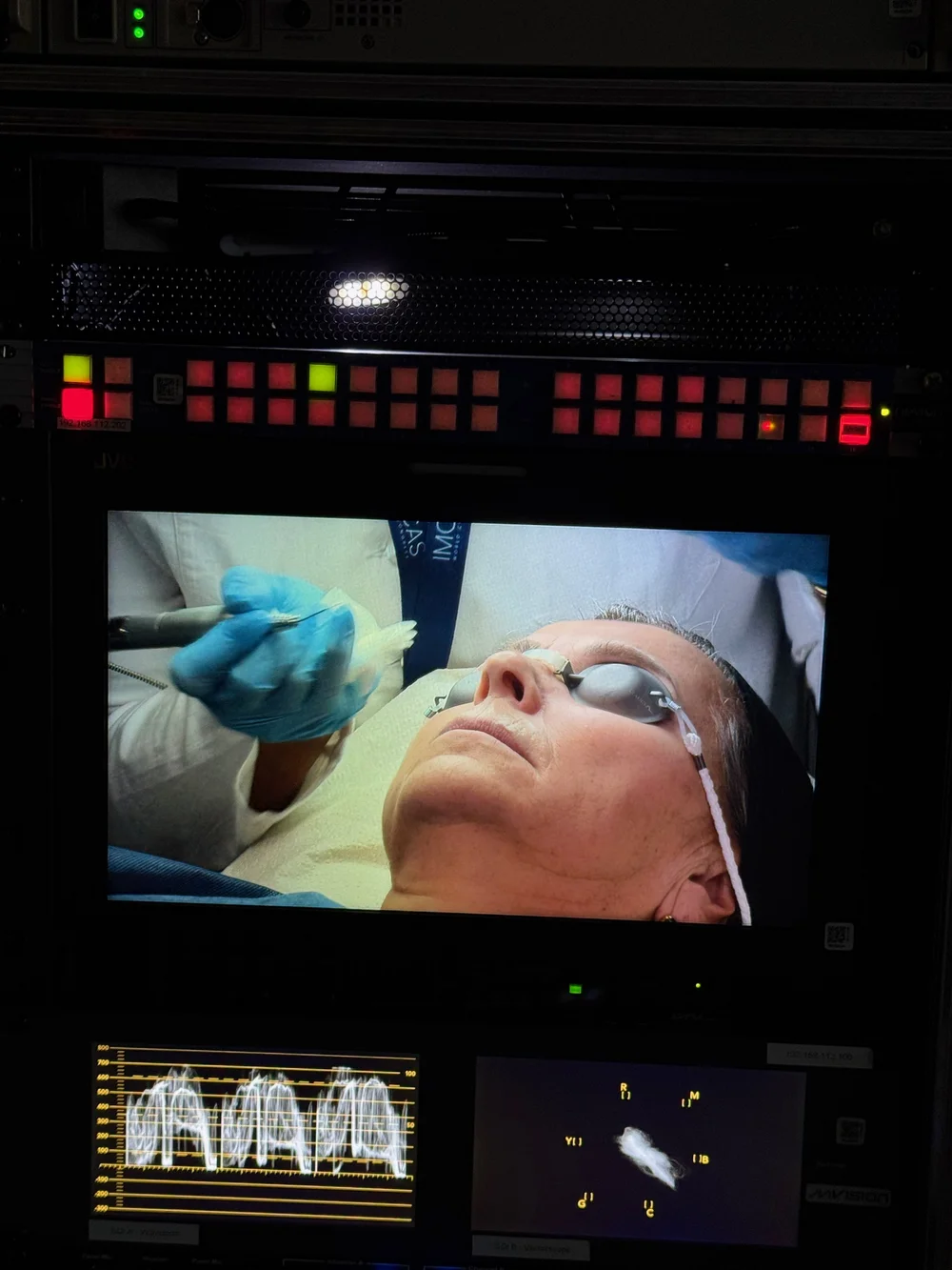 Retour vidéo d'une injection en cours